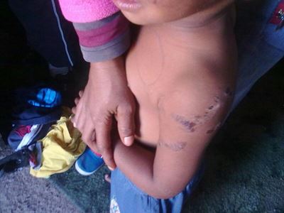 Update: Tortured toddler still in hospital